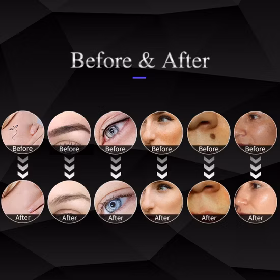 Kundenspezifischer optischer Kristall Cth ND YAG ohne End-Yap-Laserstab für die Laser-Schönheitshaarentfernung